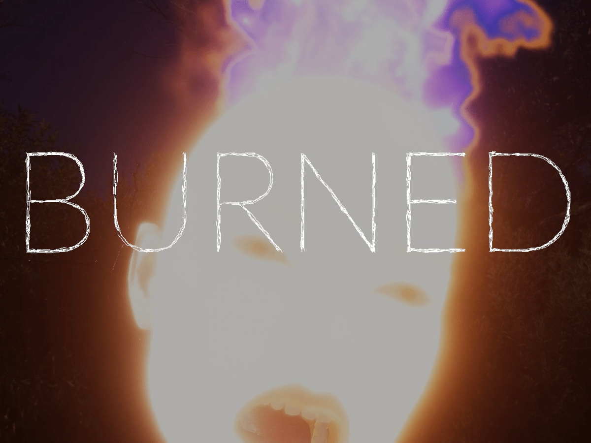 Anastasiia Vorobiova. BURNED